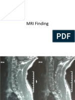 MRI Finding Case Presentation