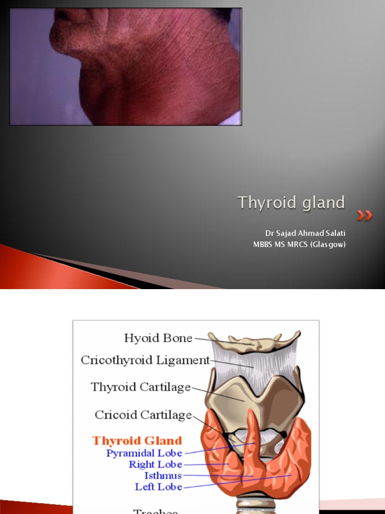 Overview of Pig Thyroid Anatomy | PDF | Thyroid | Hyperthyroidism