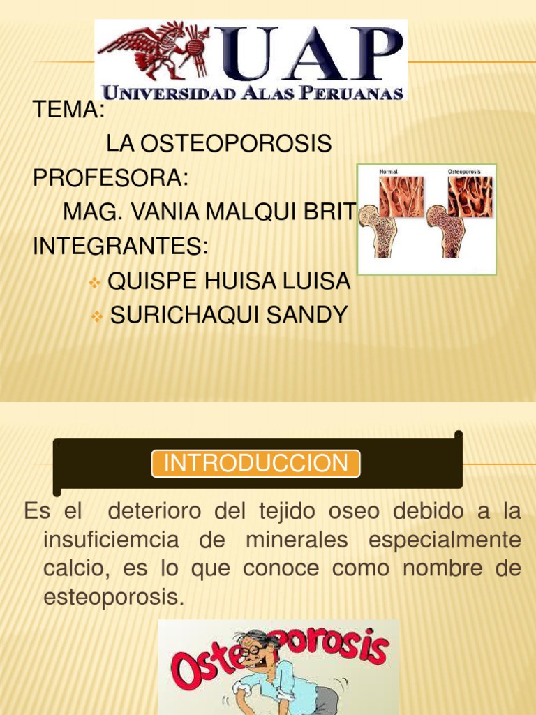 Información sobre la osteoporosis | PDF | Osteoporosis | Hueso