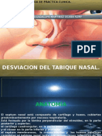 Desviacion Del Tabique Nasal