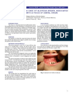 Balcheva 2009, Alopecia Areata of Dental Origin