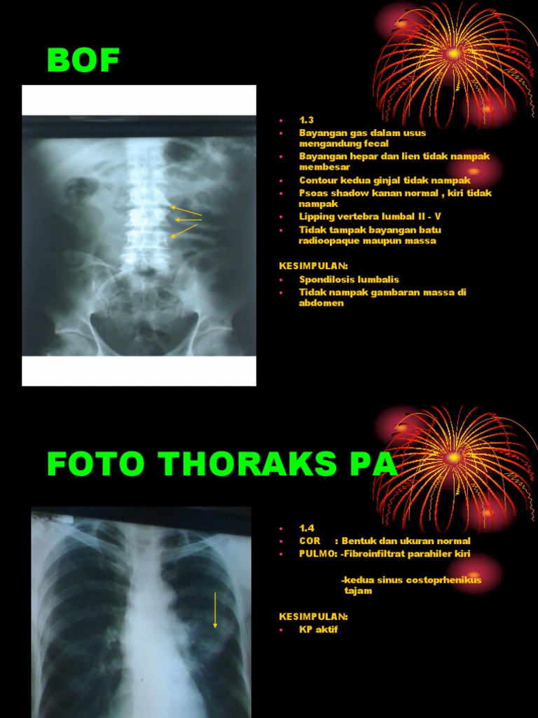 Jinsiy aloqa ogli onamni sikadi