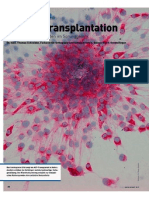 MSN 2 2012 Knorpeltherapie zur Prävention von Arthrose im Sprunggelenk