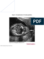 Radiographics US Anomalies