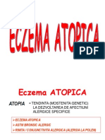 Eczema Atopica