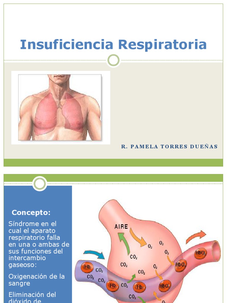 Insuficiencia Respiratoria Expo Sistema respiratorio Enfermedades y trastornos Free 30day