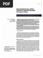 Download Semimembranosus-Tibial Collateral Ligament Bursitis by Manuel Arteaga SN113055856 doc pdf