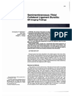 Semimembranosus-Tibial Collateral Ligament Bursitis