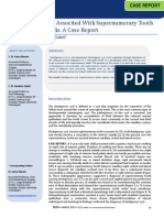 Dentigerous Cyst Associted With Supernumerary Tooth in Anterior Maxilla: A Case Report