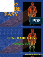 Ecg Made Easy