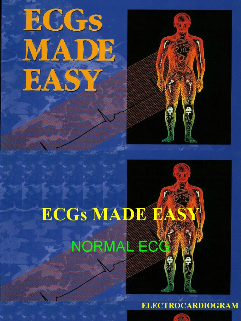 Understanding ECG Basics and Analysis | PDF
