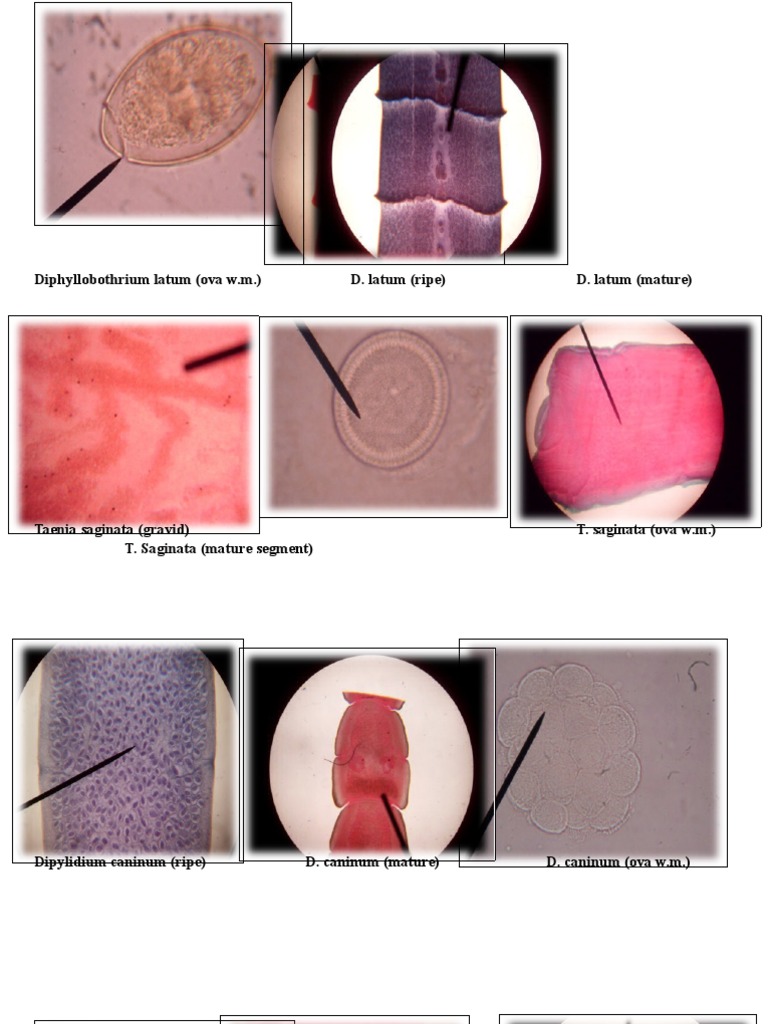 Parasitic Worm Identification Guide | PDF