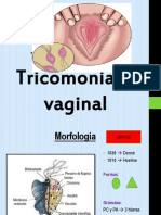 Tricomoniasis Vaginal