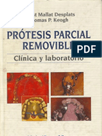 Prótesis Parcial Removible