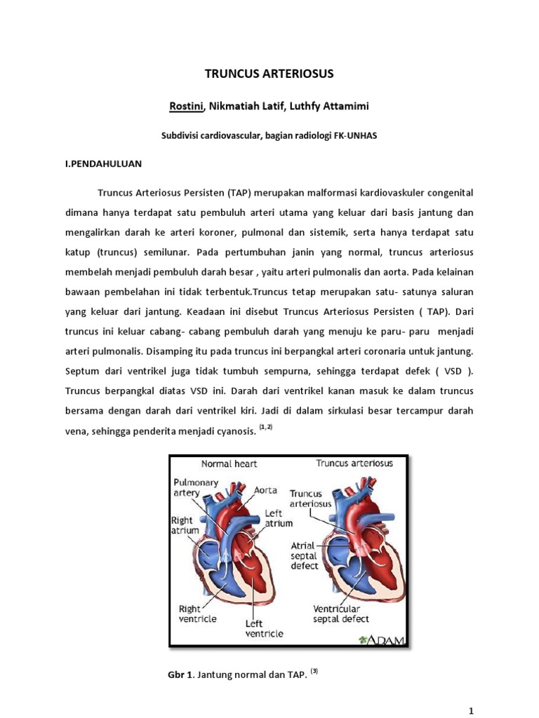 Truncus Arteriosus Persisten Refarat | PDF