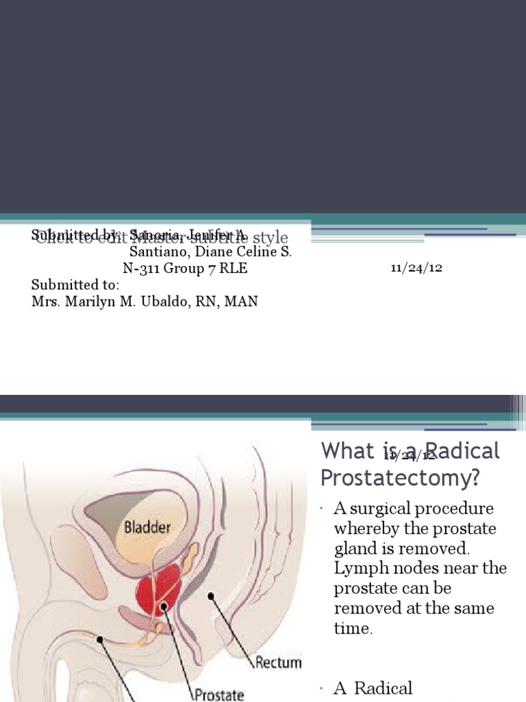 Overview of Radical Prostatectomy | PDF | Wellness