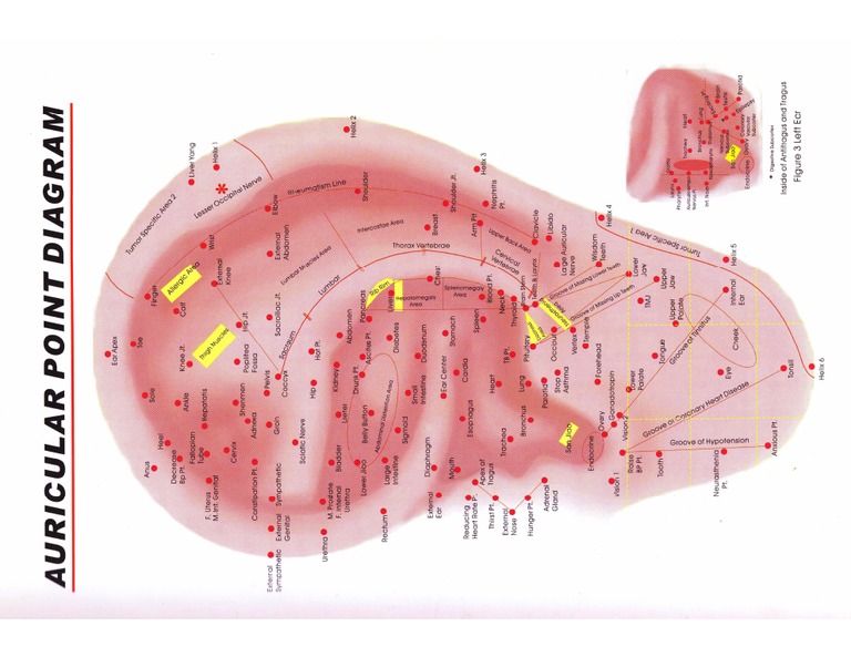 DR - Huang's Ear Chart | PDF
