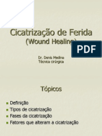 Cicatrização de Ferida (Denis)