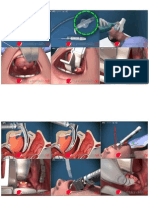 Illustrated Intubation,step by step.