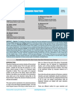 Olecranon Fracture: Dr. Muhammad Inam