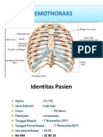 Hemothoraks Case