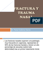 Frac Tura o Trauma Nasal