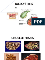 Chole Cystitis