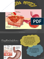 Presentación1seminario Ulcera Peptica
