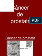 Trabalho Cancer de Prostata