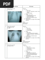 Radiologi Expertise Thorax