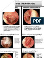 Gambaran Otomikosis