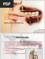 Implant Odont i A