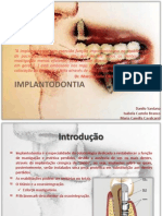 Implant Odont I A