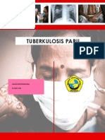 tuberkulosis