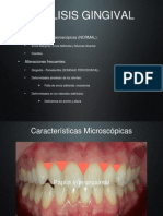 Análisis Gingival