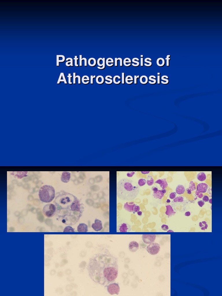 Atherosclerosis: Pathogenesis and Risks | PDF | Atherosclerosis ...