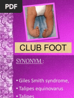 Club Foot Pdf Foot Hip