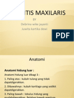 PPT Sinusitis Maxilaris.ppt 222