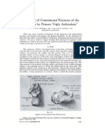 Calcaneal Fracture Treatment by Primary Arthrodesis