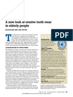 A New Look at Erosive Tooth Wear in Elderly People: JADA 2007 138 (9 Supplement) :21S-25S