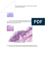 Showing Mucosal Necrosis