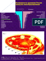 Oncology - Bladder