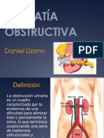 Uropatía Obstructiva