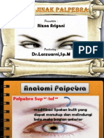 Tumor Jinak Palpebra