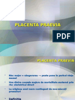 Placenta Praevia - Dppni