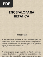 Encefalopatia Hepatica