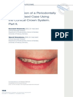 Rehabilitation of A Periodontally Compromised Case Using The Conical Crown System Part II