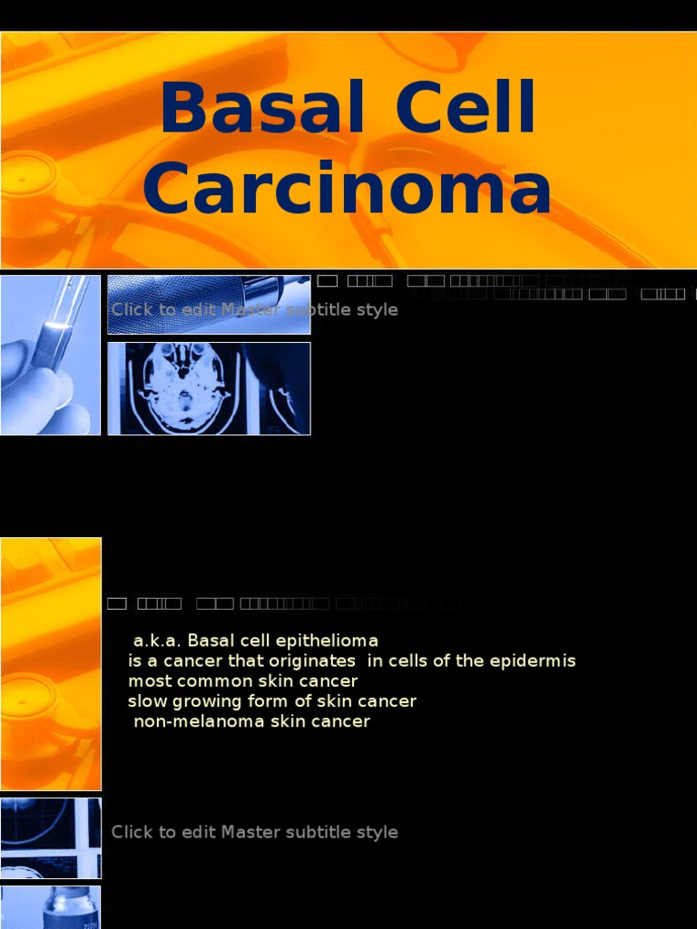 Basal Cell Carcinoma | PDF | Skin Cancer | Cancer