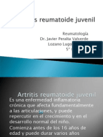 Artritis Reumatoide Juvenil