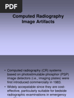 Understanding Grid Errors in Radiology | PDF | X Ray | Radiography